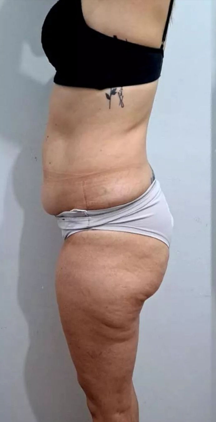 Cátia Santos | Estética e Massoterapia - Image 7