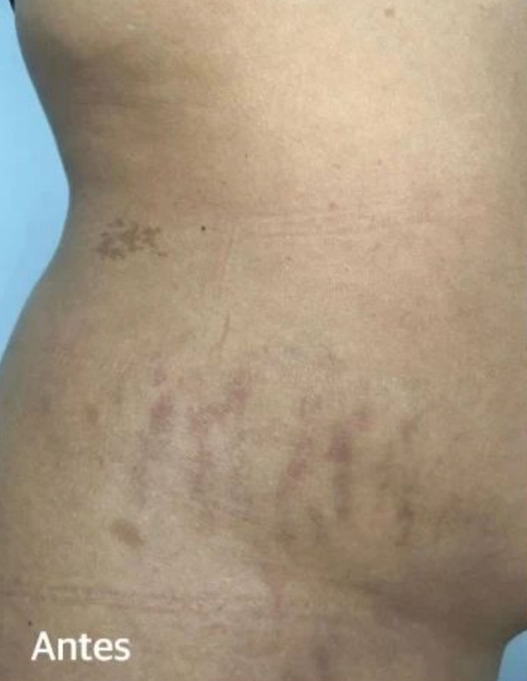 Cátia Santos | Estética e Massoterapia - Image 2