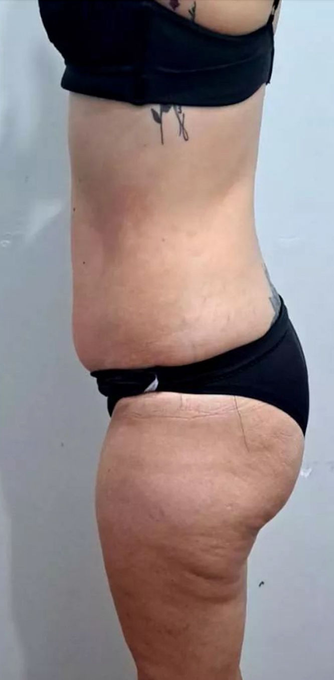 Cátia Santos | Estética e Massoterapia - Image 6