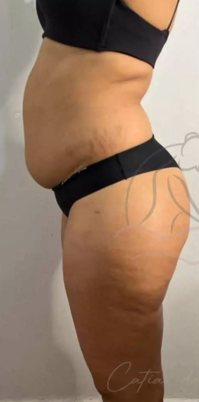 Cátia Santos | Estética e Massoterapia - Image 8