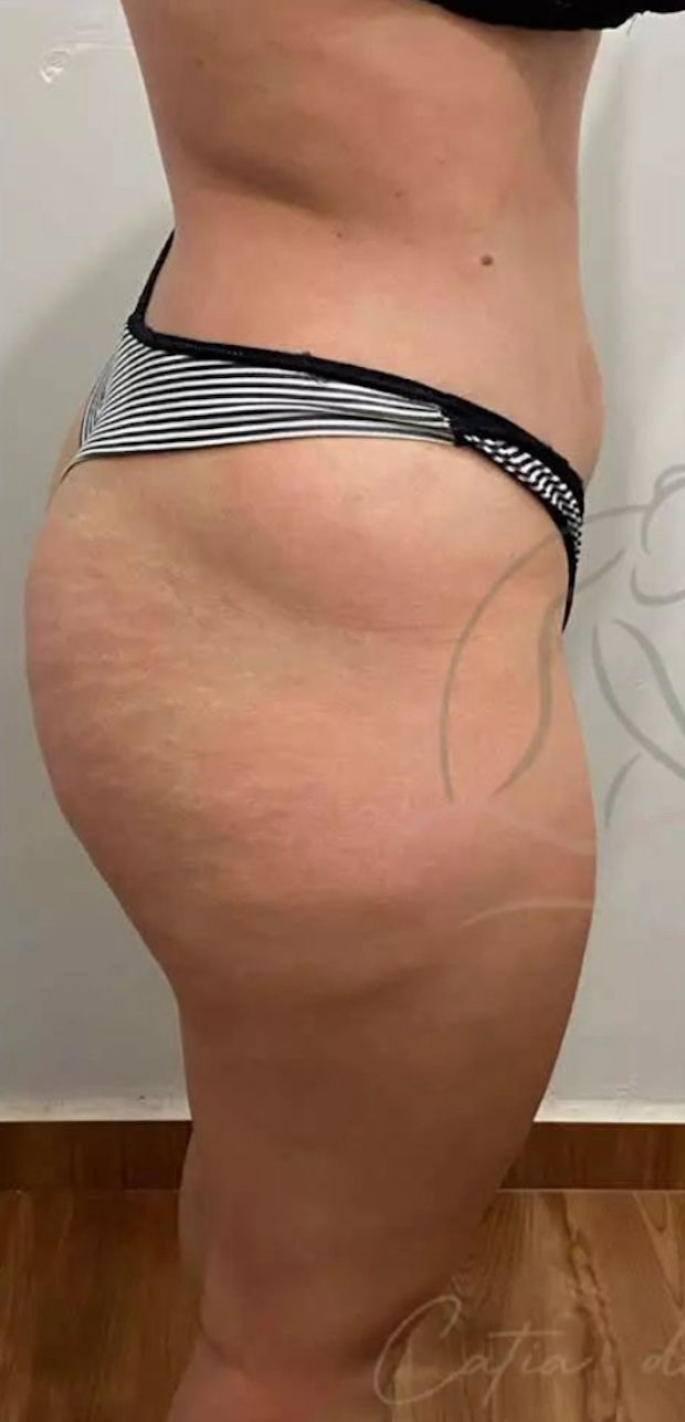 Cátia Santos | Estética e Massoterapia - Image 4