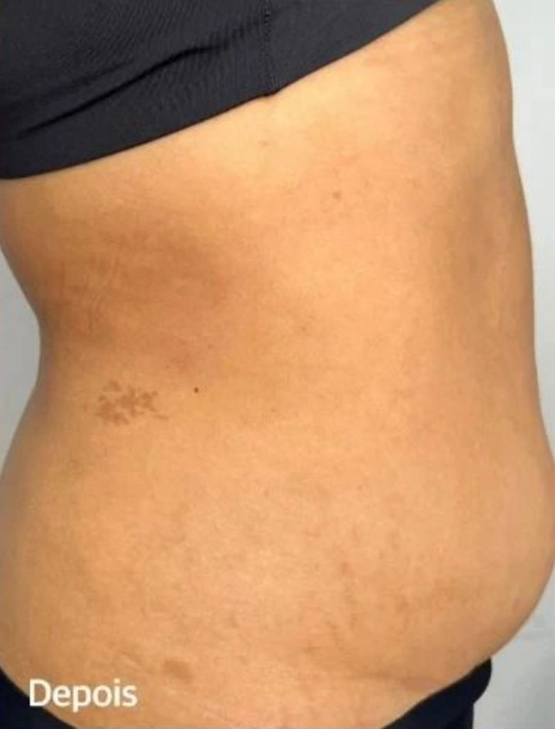Cátia Santos | Estética e Massoterapia - Image 3