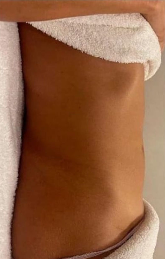 Isabel Francioli Massagem Renata França - Almada - Image 8