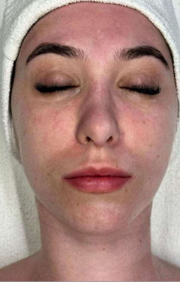 Isabel Francioli Massagem Renata França - Almada - Image 6