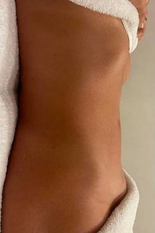 Isabel Francioli Massagem Renata França - Almada - Image 9