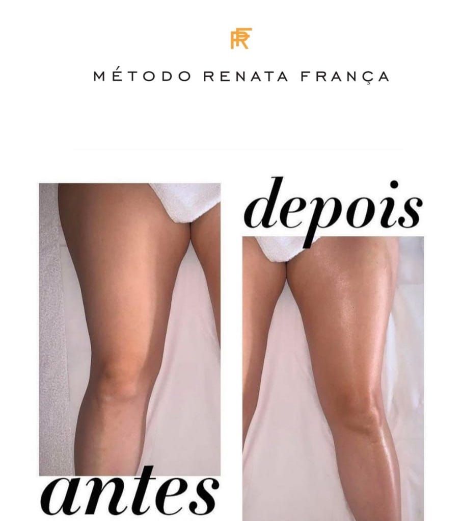 Isabel Francioli Massagem Renata França - Costa da Caparica - Image 7