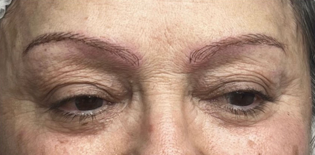 Carla Ferreira | Microblading | Despigmentação | Estética - Image 4