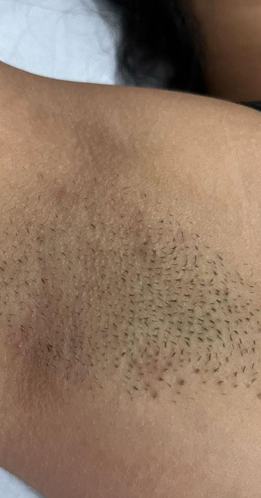 Carla Ferreira | Microblading | Despigmentação | Estética - Image 8