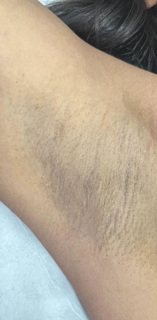 Carla Ferreira | Microblading | Despigmentação | Estética - Image 7