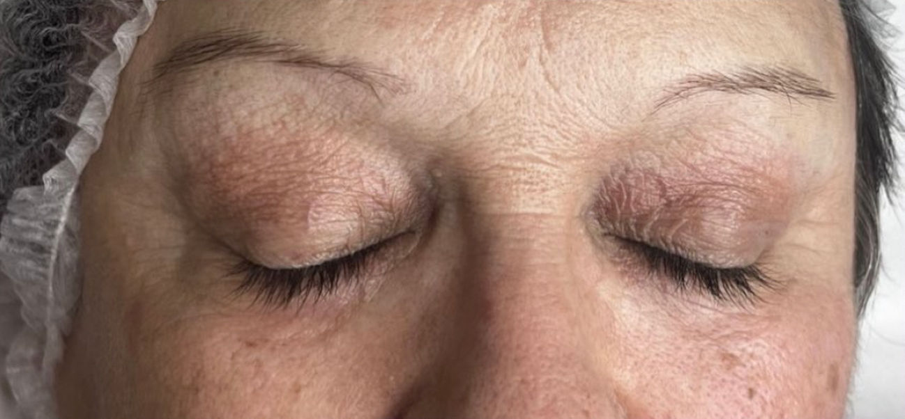 Carla Ferreira | Microblading | Despigmentação | Estética - Image 3