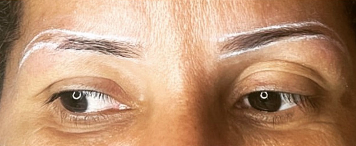 Carla Ferreira | Microblading | Despigmentação | Estética - Image 10