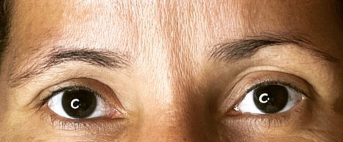 Carla Ferreira | Microblading | Despigmentação | Estética - Image 9