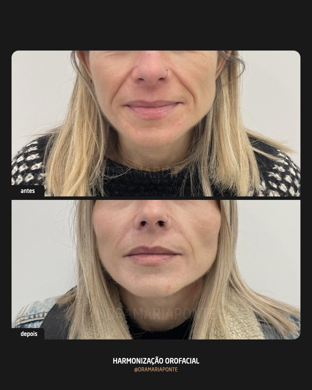 The Lisbon Smile Clinic - Image 10