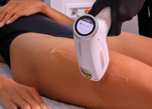 Epilação a Laser Quinta do Conde - Image 3