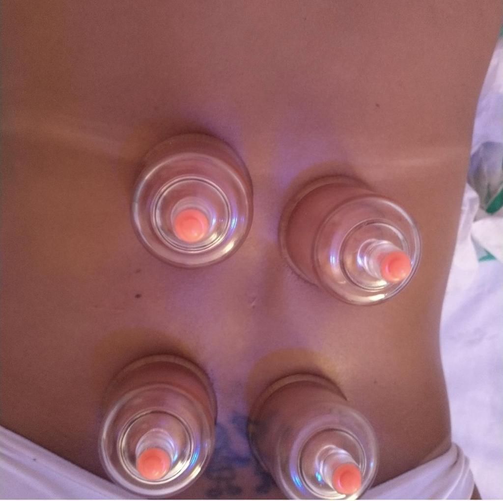 Irla Souza Fisioterapia e Estética - Image 4