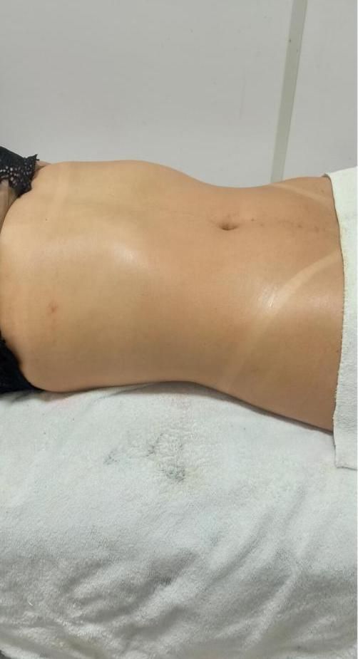 Janailde Mendes Estética - Image 11