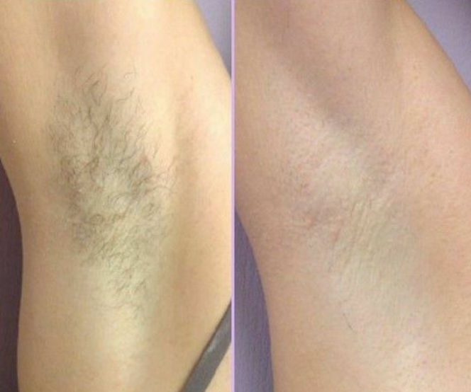 Raquel Freire Estética - Image 7