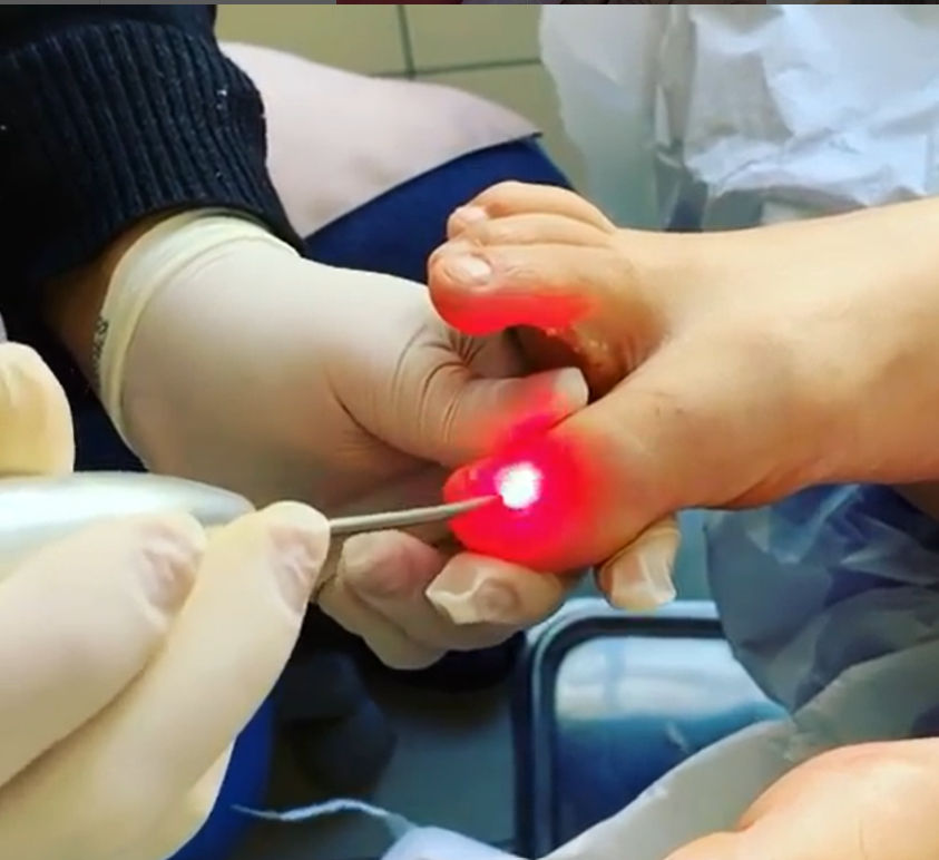 Podologia Soft Feet - Image 3