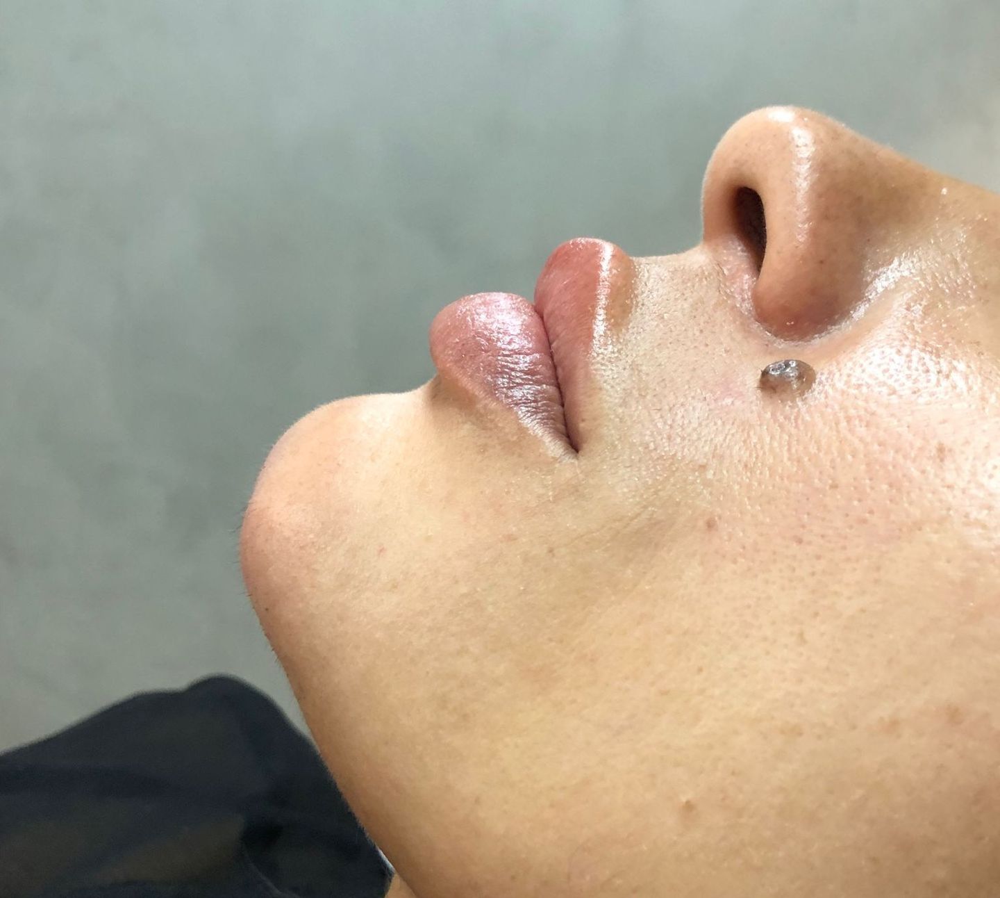 Dra. Luísa Leal Harmonização Orofacial - Image 5