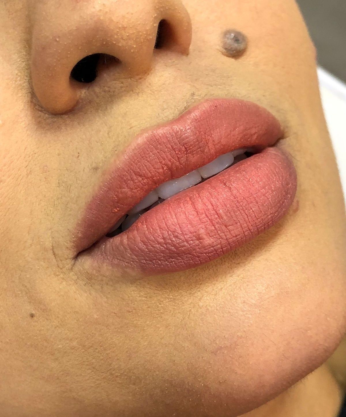 Dra. Luísa Leal Harmonização Orofacial - Image 3