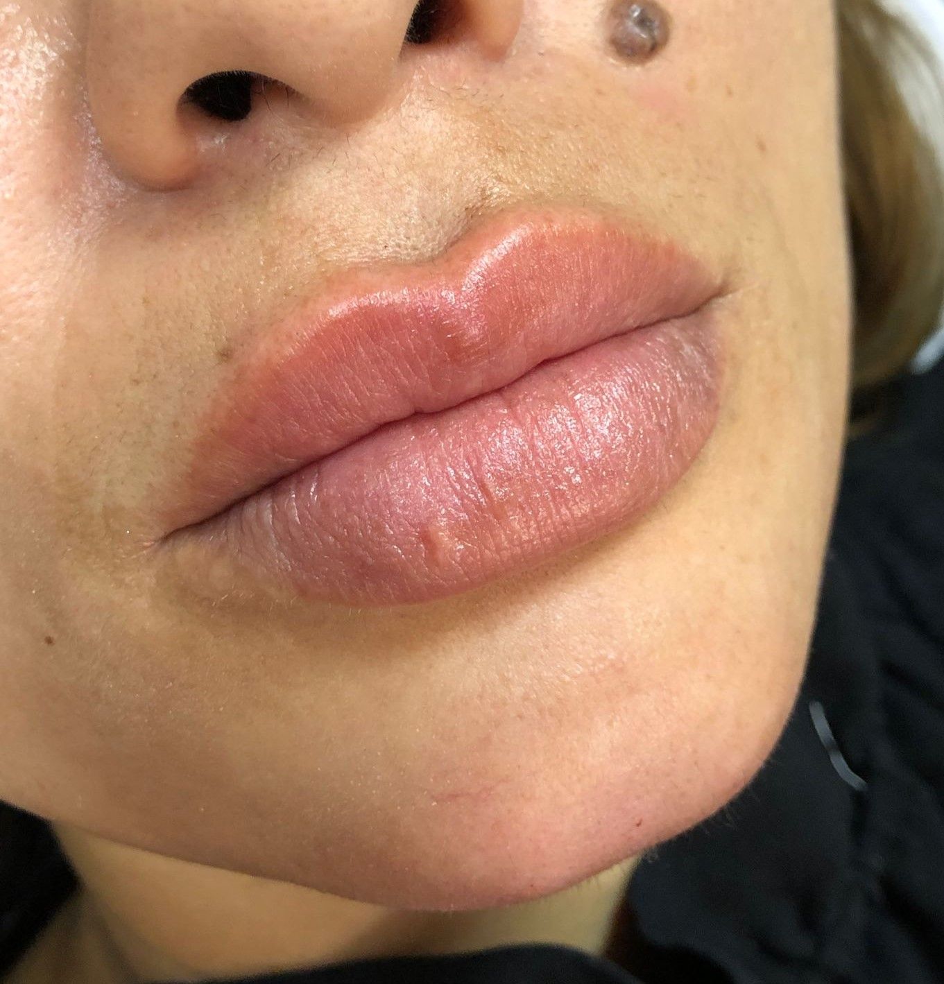 Dra. Luísa Leal Harmonização Orofacial - Image 2