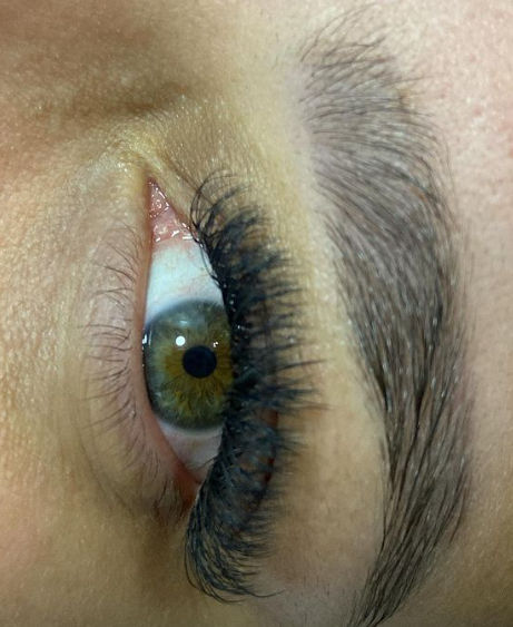 Depil Estética - Image 8