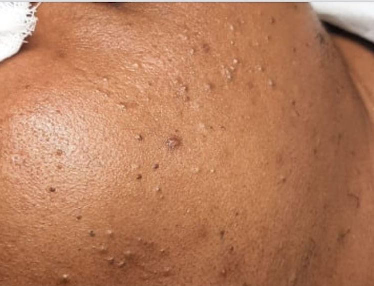Sandra Bastos - Estética Dermatofuncional - Image 7