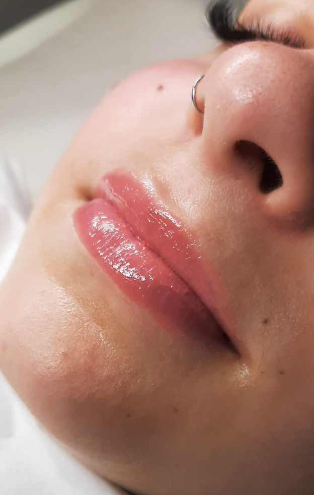 Sandra Bastos - Estética Dermatofuncional - Image 6