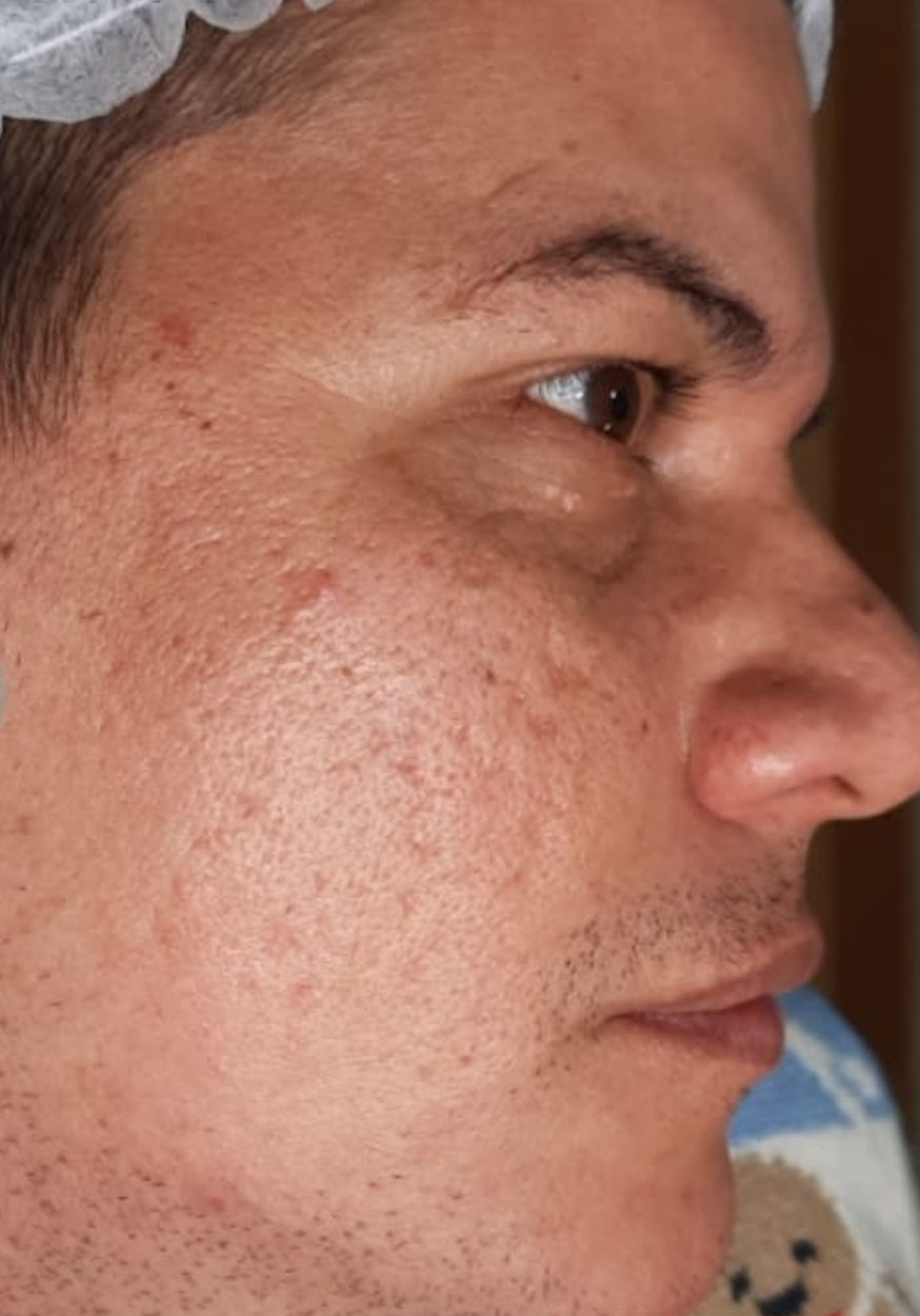 Sandra Bastos - Estética Dermatofuncional - Image 10