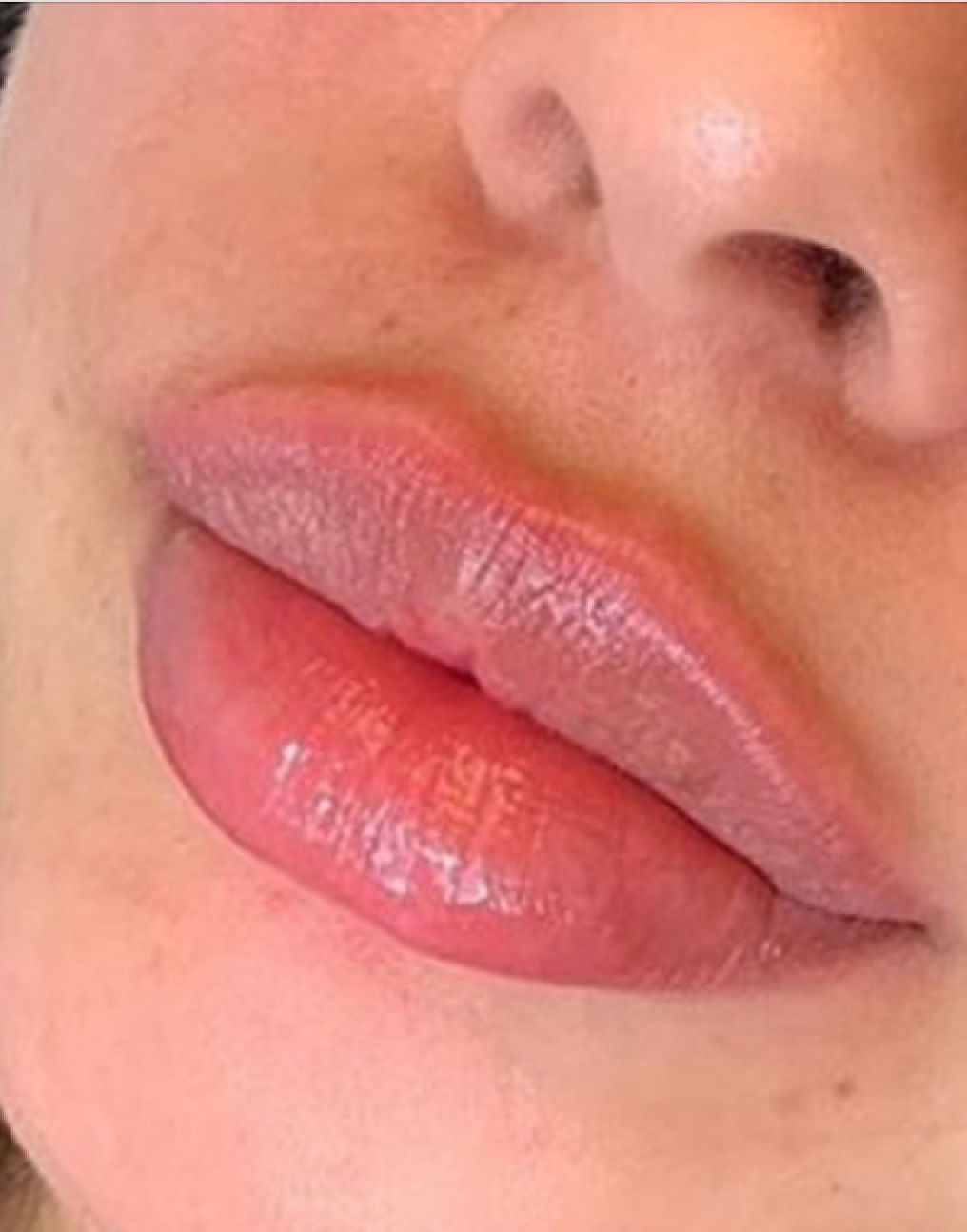 Sandra Bastos - Estética Dermatofuncional - Image 5