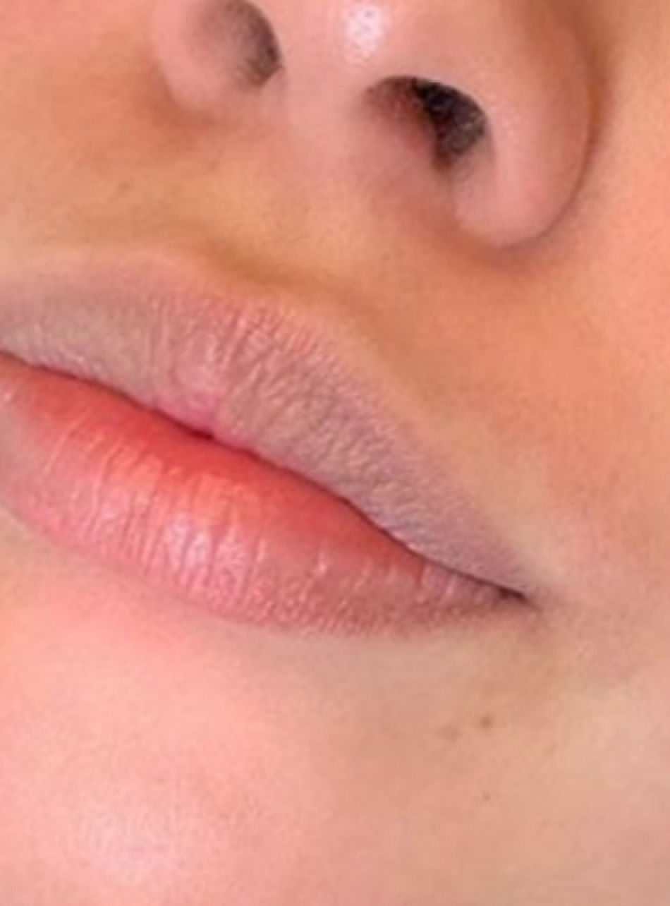 Sandra Bastos - Estética Dermatofuncional - Image 4