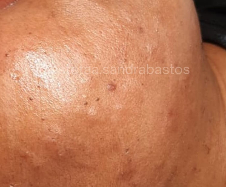 Sandra Bastos - Estética Dermatofuncional - Image 8