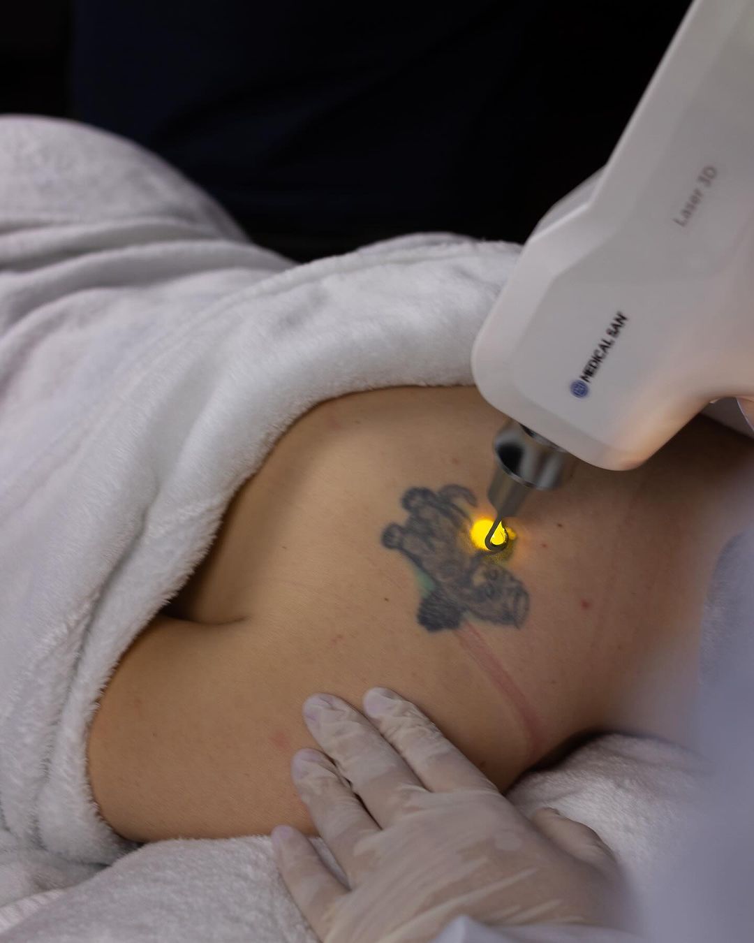Marcelo Jardim - Remoção de Tatuagem e Micropigmentação - Image 3