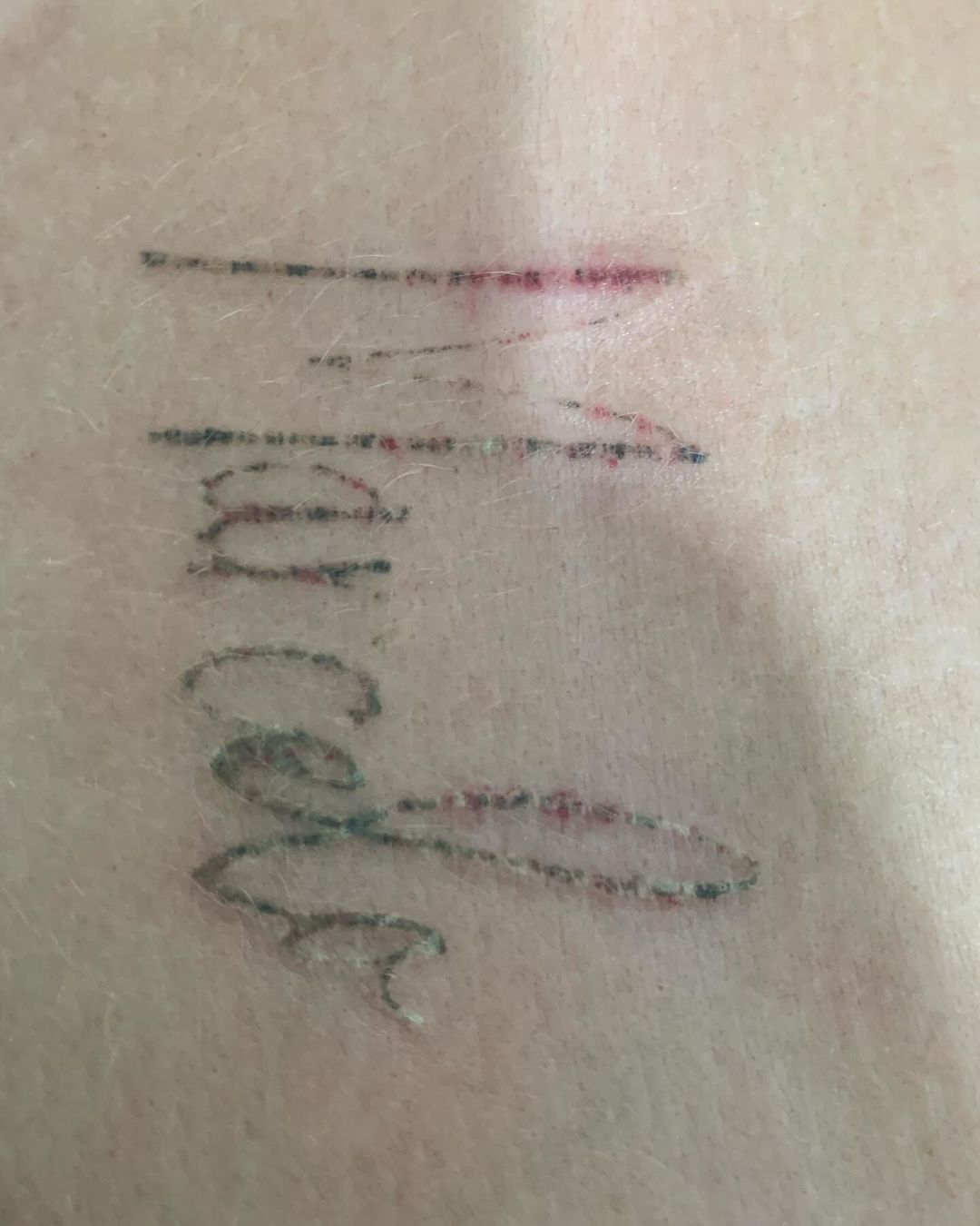 Marcelo Jardim - Remoção de Tatuagem e Micropigmentação - Image 4