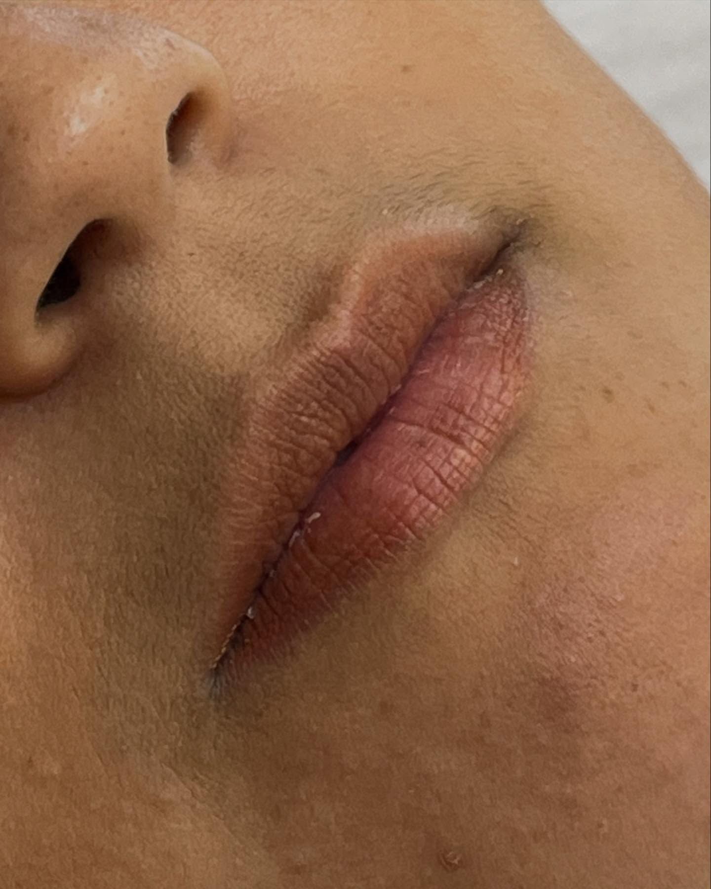 Belle Santé | Clínica de Estética e Instituto - Image 4