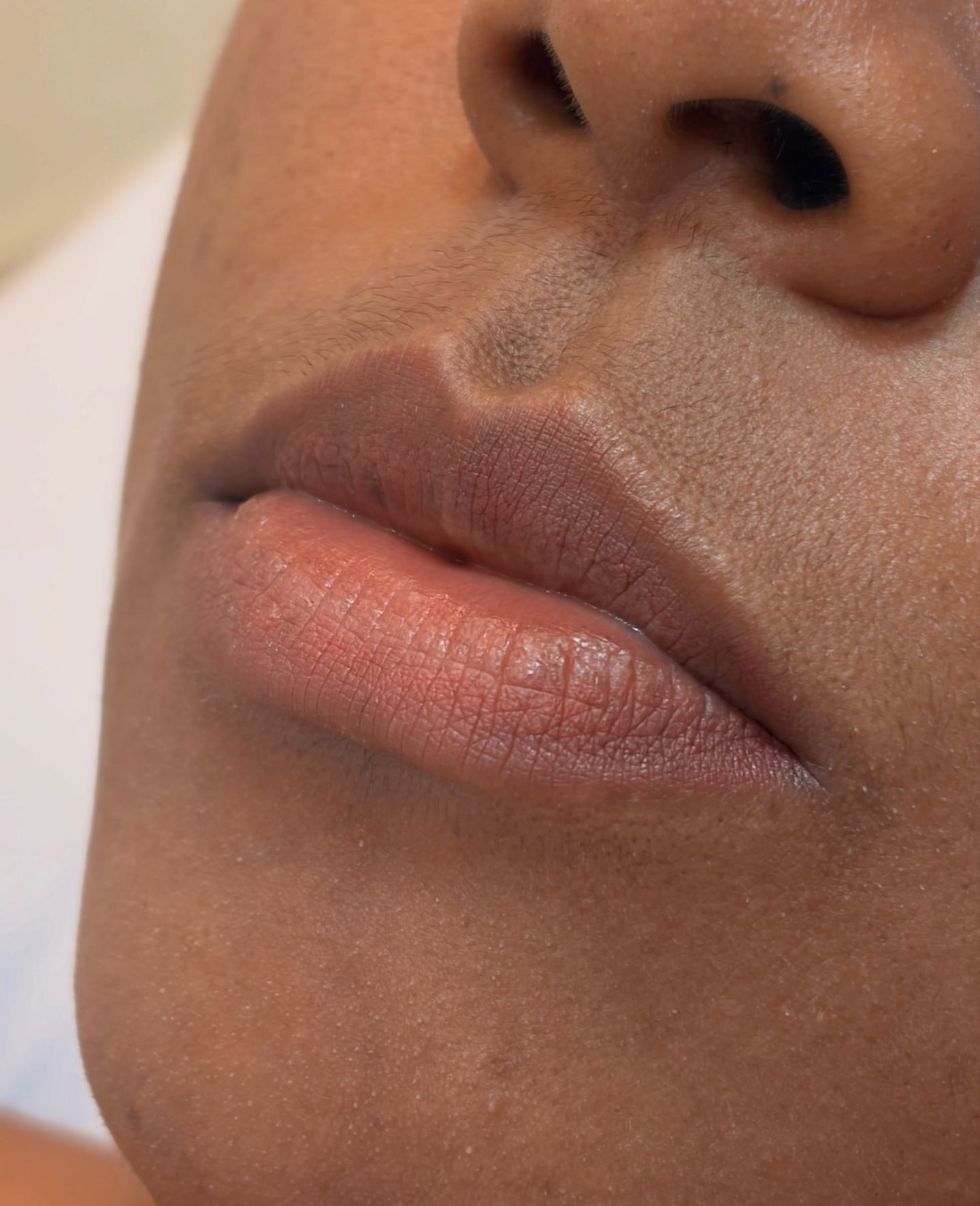 Belle Santé | Clínica de Estética e Instituto - Image 1