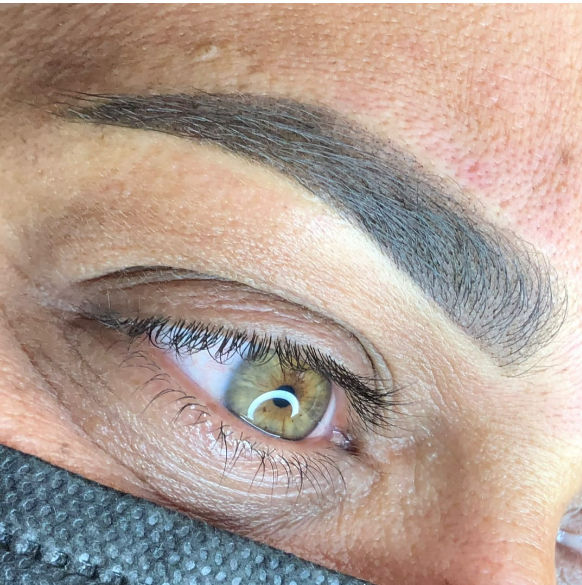 Derma Pelle - Image 8
