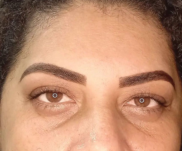 Taináh Souza Estética Mania - Image 6