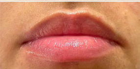 EstetiKa Beauty - Image 5