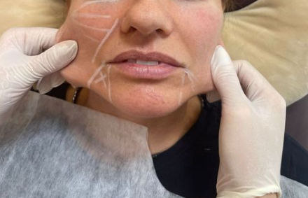 Bella Mooca Estética - Unidade Paulista - Image 3