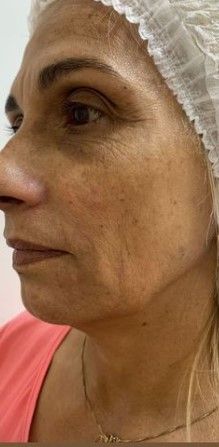 Bella Mooca Estética - Unidade Paulista - Image 5