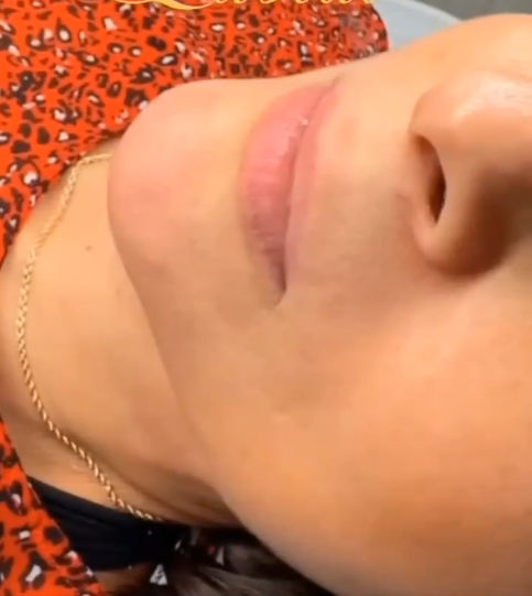 Clínica de Estética Belle de Jour - Image 2