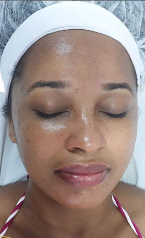 Dra. Jamile Fagundes- Estética Avançada - Image 7