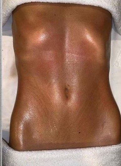 Rosana Duca Estética Integrativa - Image 1
