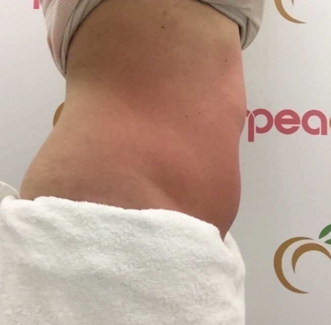 Peach - Image 11