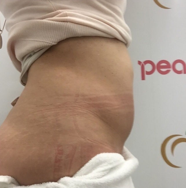 Peach - Image 10