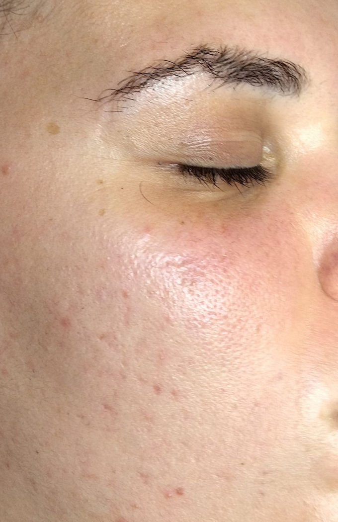 Ana Moreira Estética - Carregado - Image 8