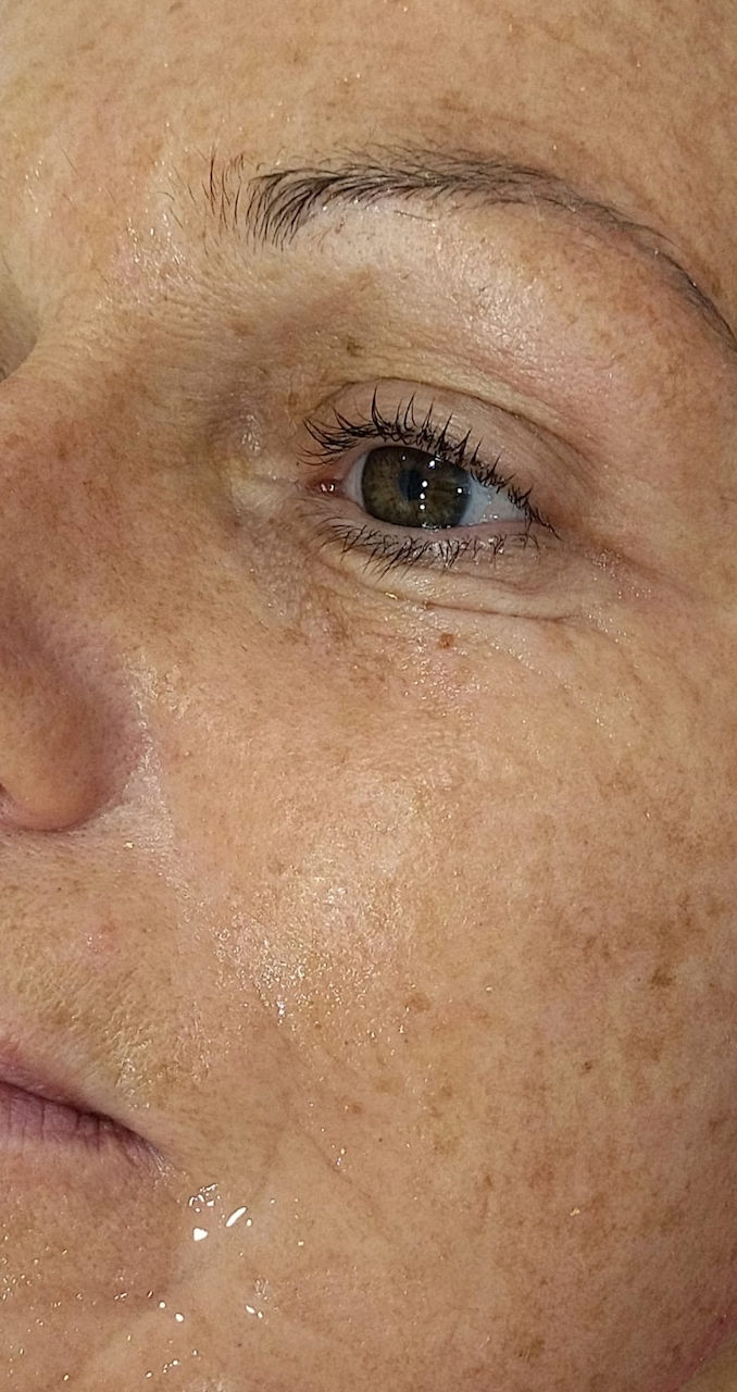 Ana Moreira Estética - Carregado - Image 20