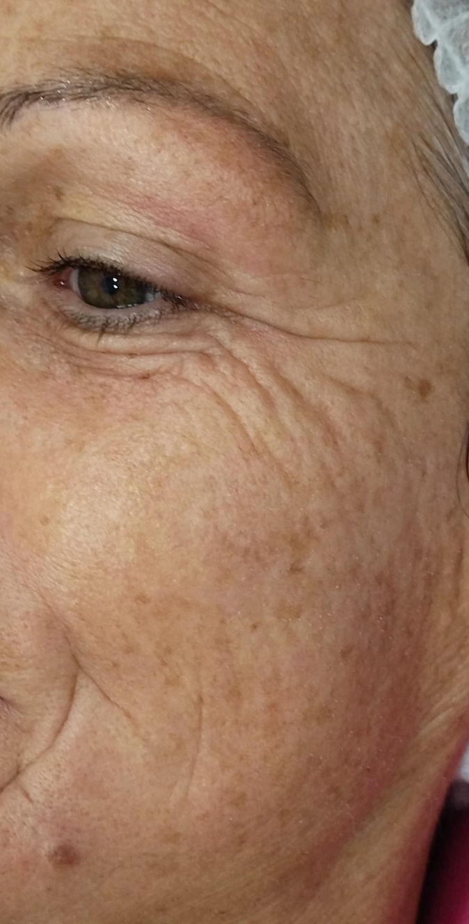 Ana Moreira Estética - Carregado - Image 19