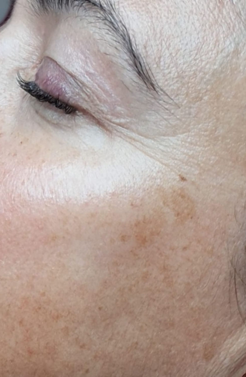 Ana Moreira Estética - Póvoa de Santa Iria - Image 11
